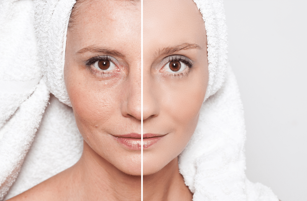 Lift and Glow: Skin Tightening Facials Near You